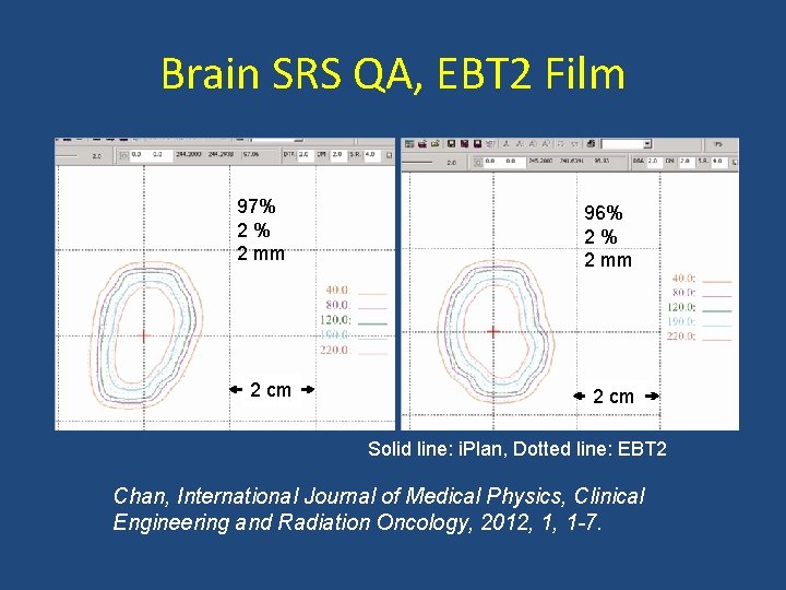 Brain SRS QA, EBT 2 Film 97% 2% 2 mm 2 cm 96% 2%