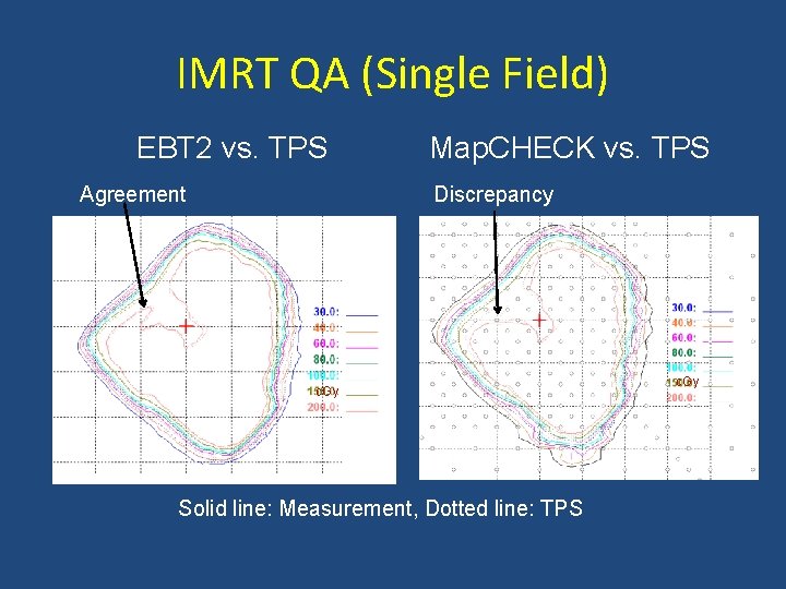 IMRT QA (Single Field) EBT 2 vs. TPS Agreement Map. CHECK vs. TPS Discrepancy