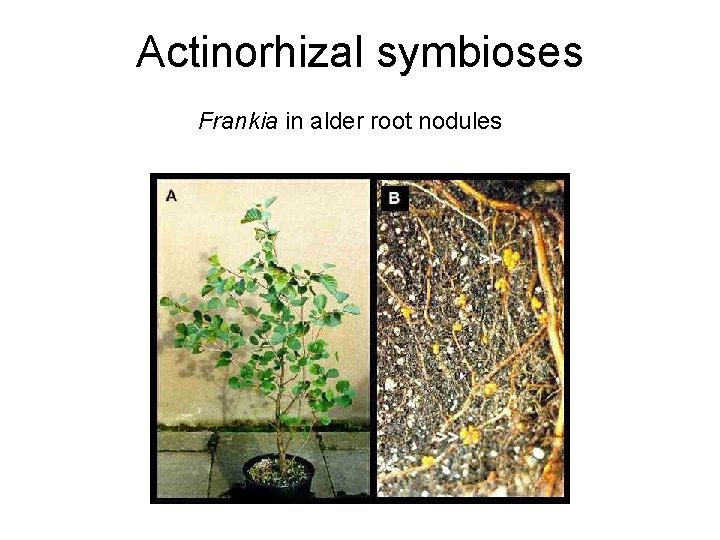 Actinorhizal symbioses Frankia in alder root nodules 