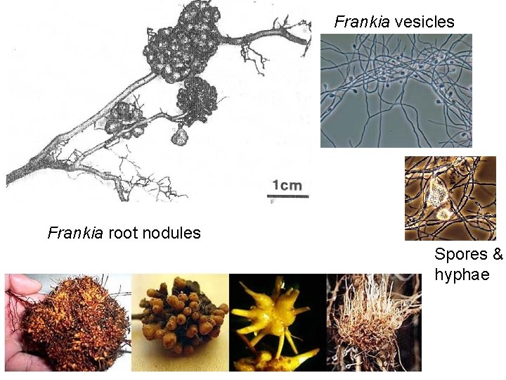 Frankia vesicles Frankia root nodules Spores & hyphae 
