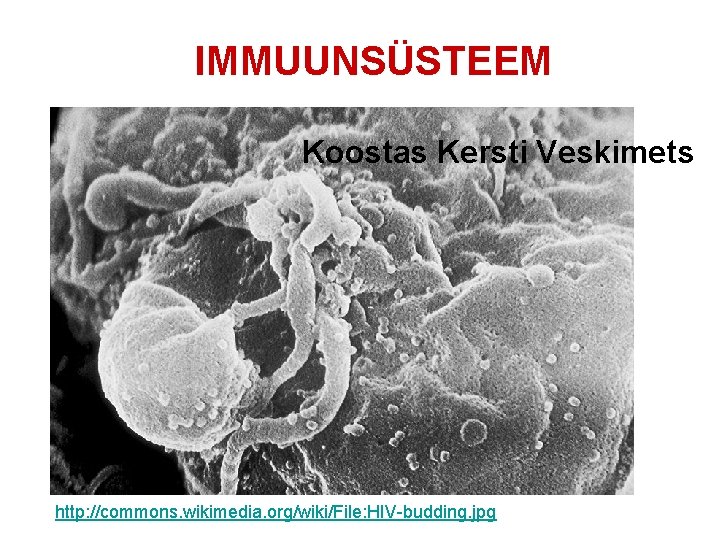 IMMUUNSÜSTEEM Koostas Kersti Veskimets http: //commons. wikimedia. org/wiki/File: HIV-budding. jpg 