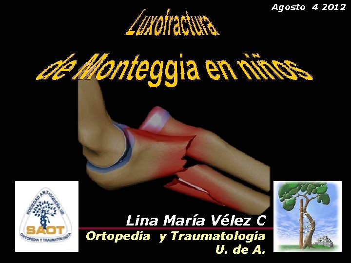 Agosto 4 2012 Lina María Vélez C Ortopedia y Traumatologia U. de A. 