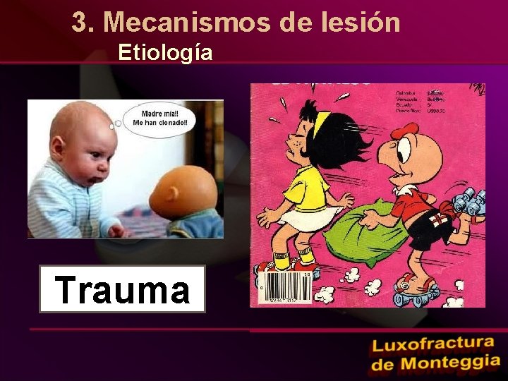 3. Mecanismos de lesión Etiología Trauma 