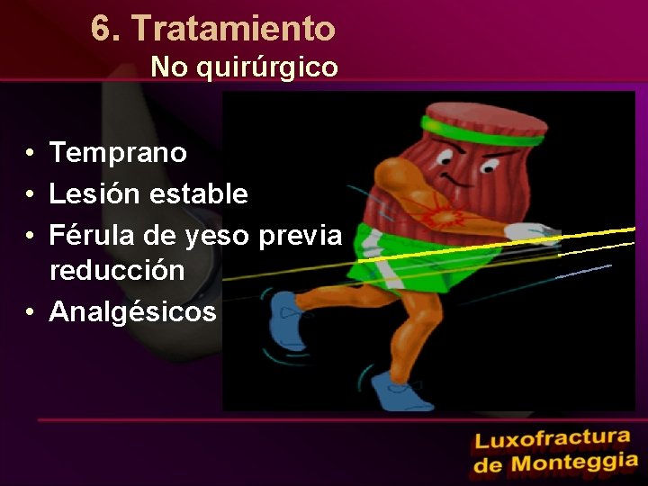 6. Tratamiento No quirúrgico • Temprano • Lesión estable • Férula de yeso previa