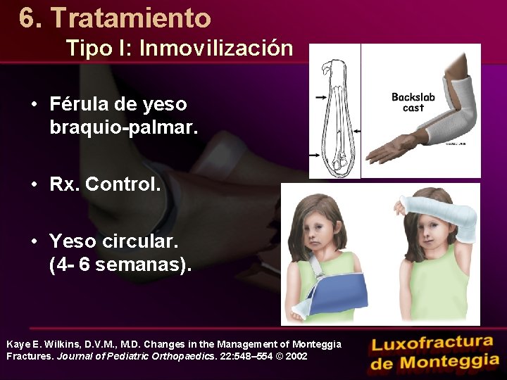 6. Tratamiento Tipo I: Inmovilización • Férula de yeso braquio-palmar. • Rx. Control. •