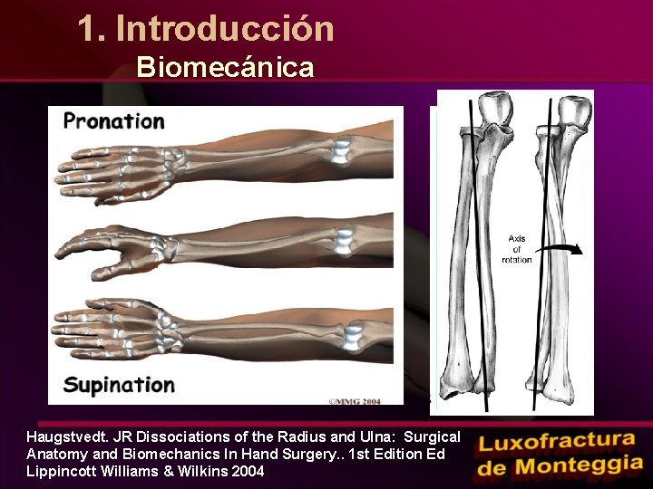 1. Introducción Biomecánica Haugstvedt. JR Dissociations of the Radius and Ulna: Surgical Anatomy and