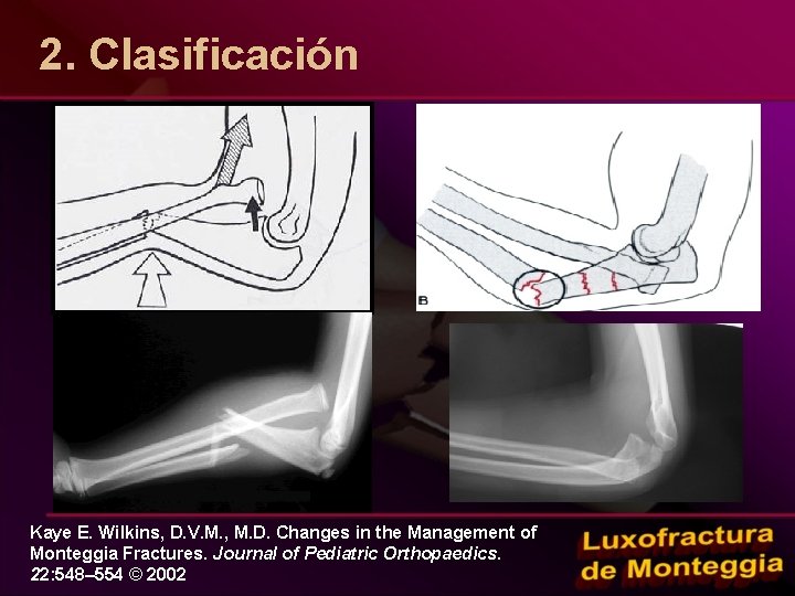 2. Clasificación Kaye E. Wilkins, D. V. M. , M. D. Changes in the