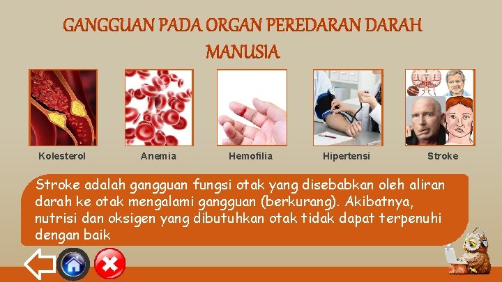 “ “ Kolesterol Anemia “ Hemofilia “ Hipertensi Stroke adalah gangguan fungsi otak yang