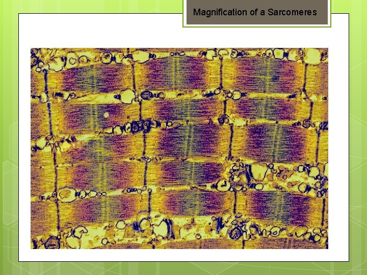 Magnification of a Sarcomeres 