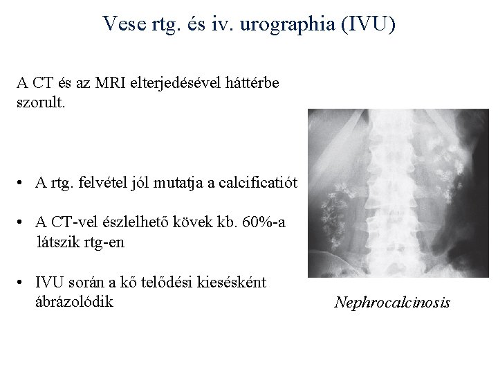 Vese rtg. és iv. urographia (IVU) A CT és az MRI elterjedésével háttérbe szorult.