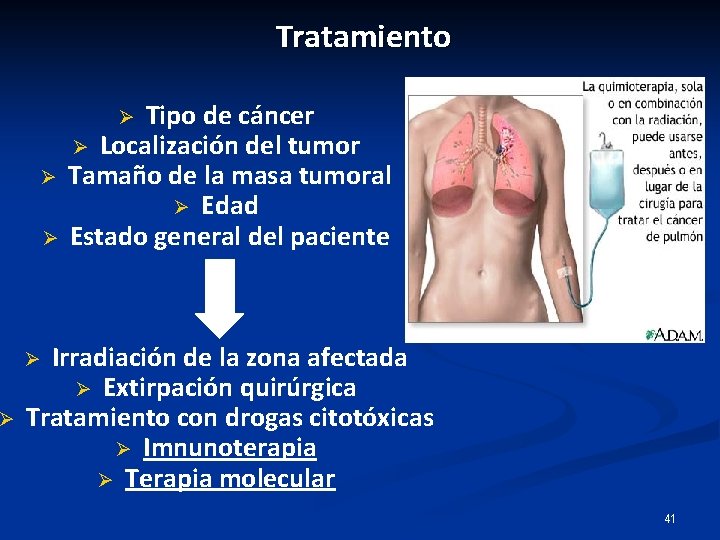 Ø Tratamiento Tipo de cáncer Ø Localización del tumor Tamaño de la masa tumoral