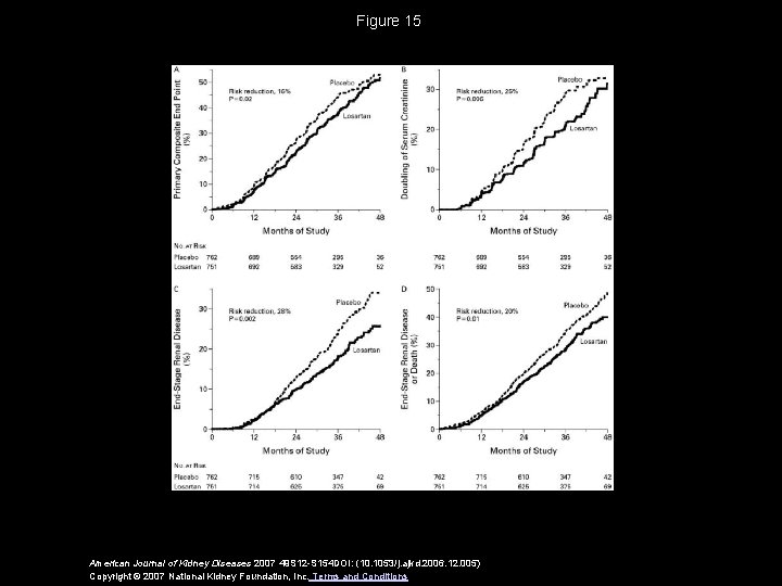 Figure 15 American Journal of Kidney Diseases 2007 49 S 12 -S 154 DOI: