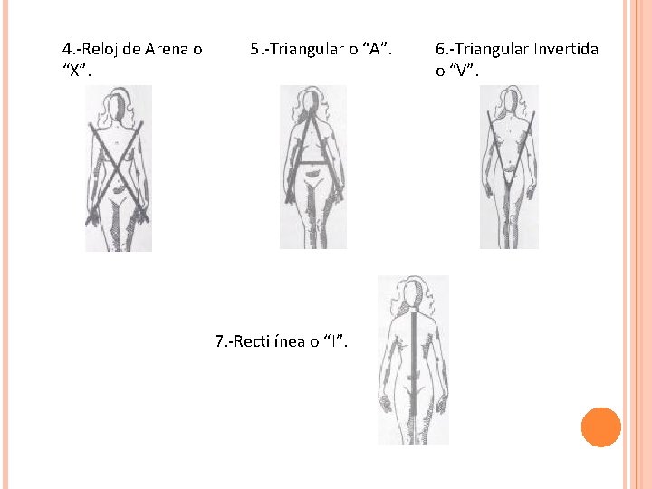 4. -Reloj de Arena o “X”. 5. -Triangular o “A”. 7. -Rectilínea o “I”.