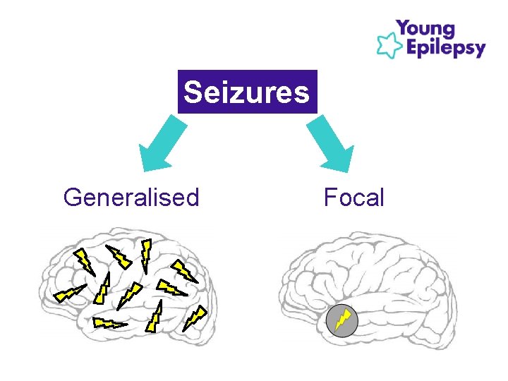 Seizures Generalised Focal Seizures Generalised Focal