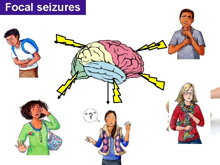 Focal seizures Focal seizures
