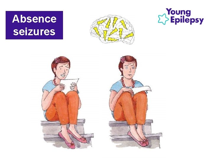Absence seizures Absence seizures