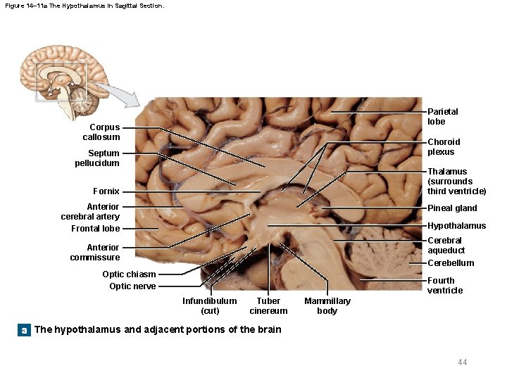 Figure 14– 11 a The Hypothalamus in Sagittal Section. Parietal lobe Corpus callosum Choroid