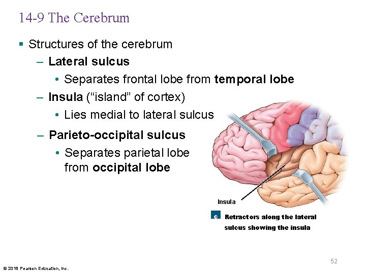 14 -9 The Cerebrum § Structures of the cerebrum – Lateral sulcus • Separates