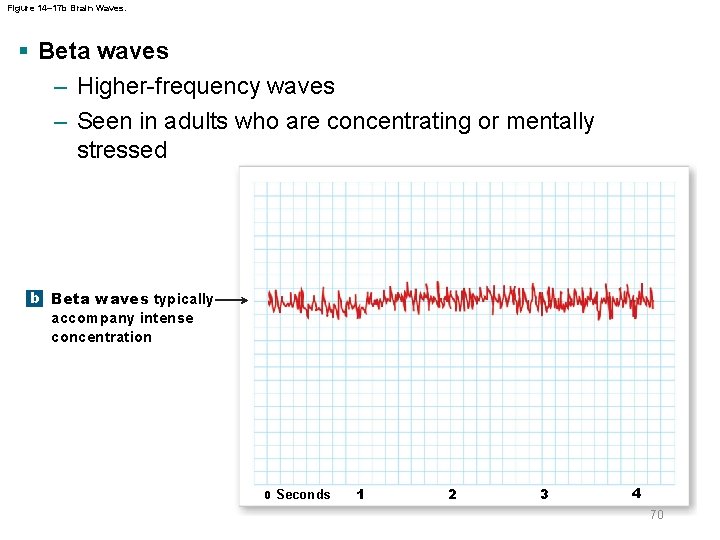 Figure 14– 17 b Brain Waves. § Beta waves – Higher-frequency waves – Seen