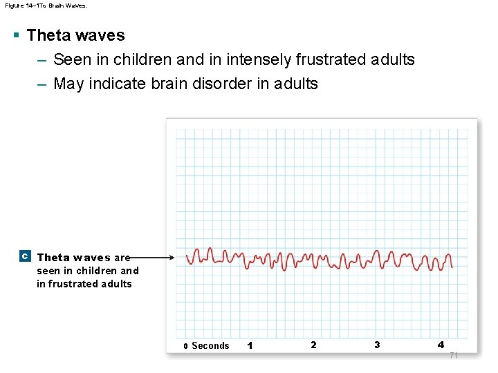 Figure 14– 17 c Brain Waves. § Theta waves – Seen in children and