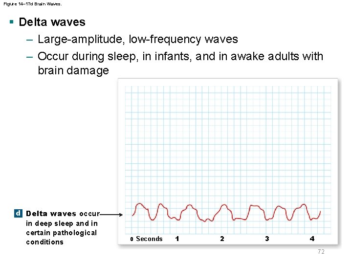 Figure 14– 17 d Brain Waves. § Delta waves – Large-amplitude, low-frequency waves –