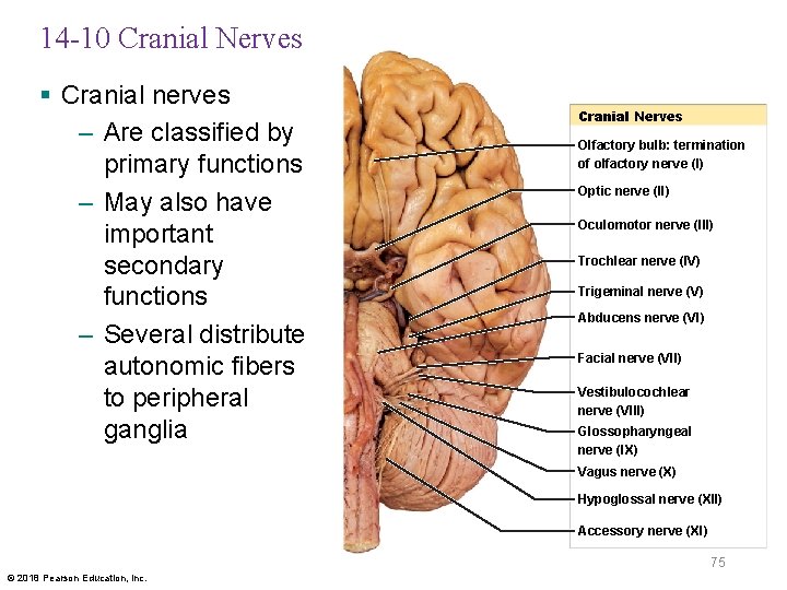 14 -10 Cranial Nerves § Cranial nerves – Are classified by primary functions –