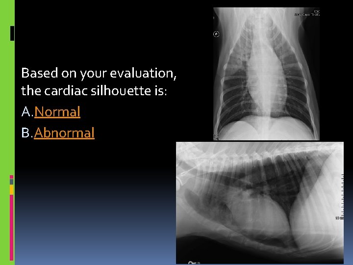 Based on your evaluation, the cardiac silhouette is: A. Normal B. Abnormal 