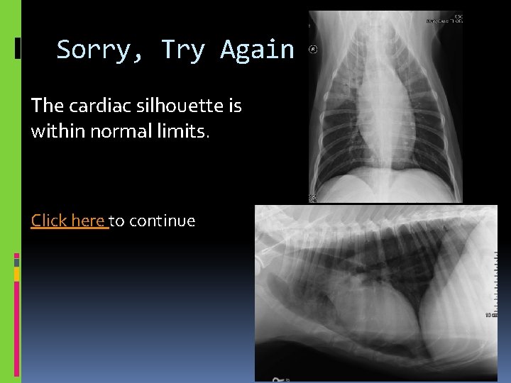 Sorry, Try Again The cardiac silhouette is within normal limits. Click here to continue
