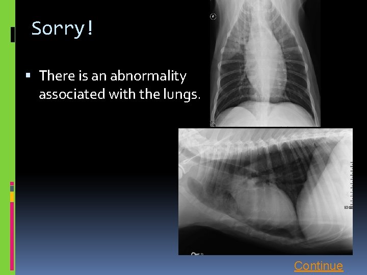 Sorry! There is an abnormality associated with the lungs. Continue 