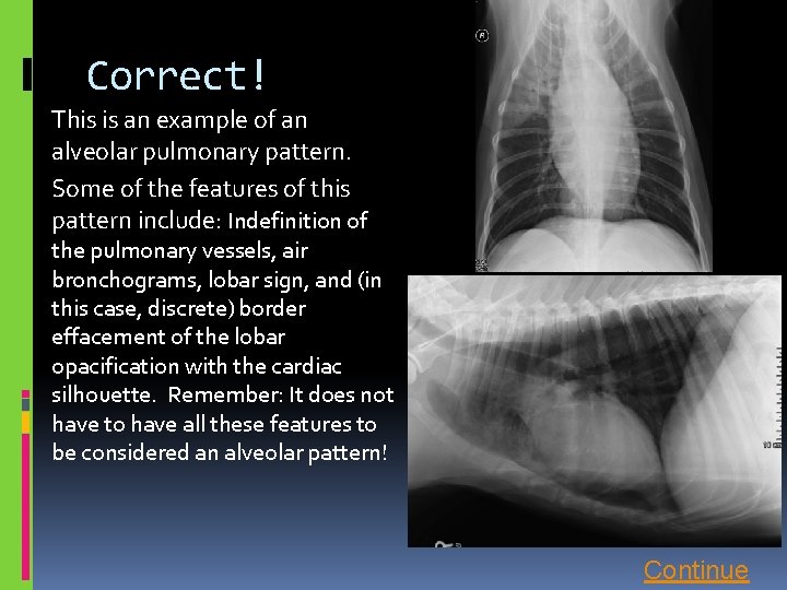 Correct! This is an example of an alveolar pulmonary pattern. Some of the features