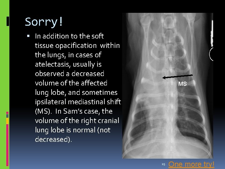 Sorry! In addition to the soft tissue opacification within the lungs, in cases of