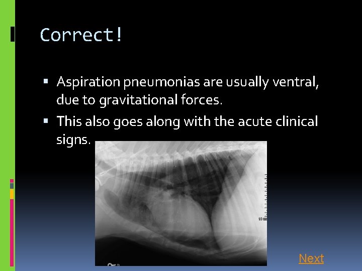 Correct! Aspiration pneumonias are usually ventral, due to gravitational forces. This also goes along