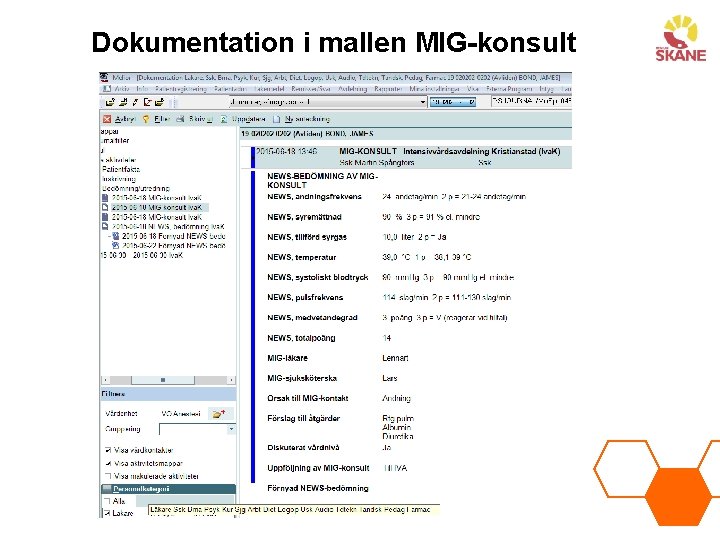 Dokumentation i mallen MIG-konsult 