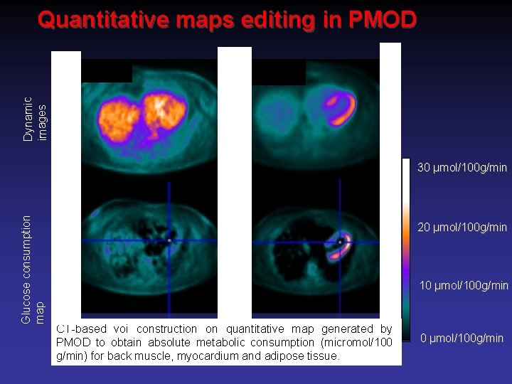 Dynamic images Quantitative maps editing in PMOD Glucose consumption map 30 µmol/100 g/min 20