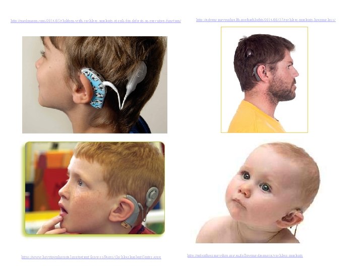 http: //medimoon. com/2014/05/children-with-cochlear-implants-at-risk-for-deficits-in-executive-function/ https: //www. boystownhospital. org/patient. Services/Pages/Cochlear. Implant. Center. aspx http: //advancingyourhealth. org/highlights/2014/08/27/cochlear-implants-hearing-loss/