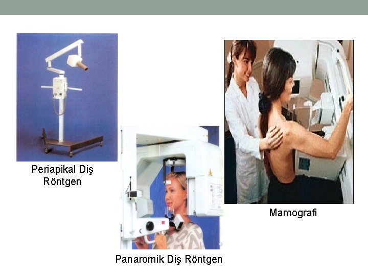 Periapikal Diş Röntgen Mamografi Panaromik Diş Röntgen 