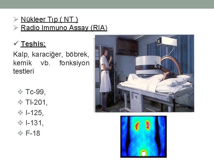 Ø Nükleer Tıp ( NT ) Ø Radio Immuno Assay (RIA) ü Teşhis; Kalp,