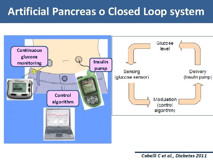 Artificial Pancreas o Closed Loop system Continuous glucose monitoring Insulin pump Control algorithm Cobelli