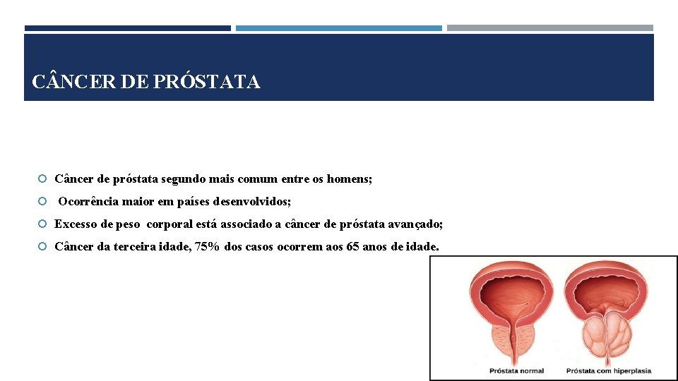 C NCER DE PRÓSTATA Câncer de próstata segundo mais comum entre os homens; Ocorrência