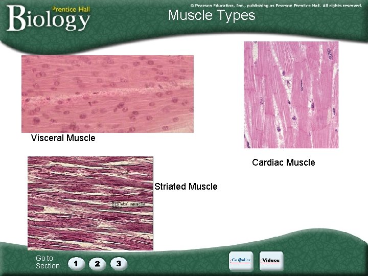 Muscle Types Visceral Muscle Cardiac Muscle Striated Muscle Go to Section: 