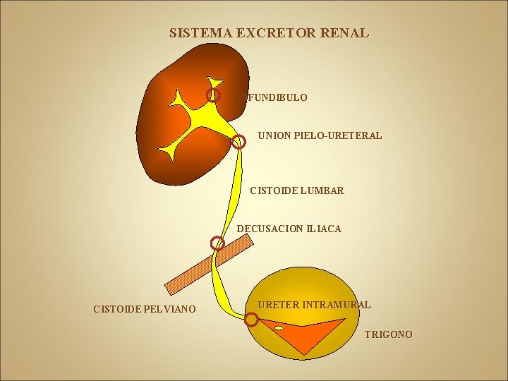 SISTEMA EXCRETOR RENAL INFUNDIBULO UNION PIELO-URETERAL CISTOIDE LUMBAR DECUSACION ILIACA CISTOIDE PELVIANO URETER INTRAMURAL
