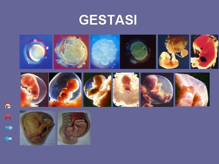 GESTASI 