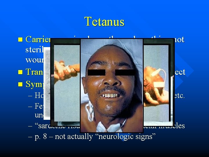 Tetanus Carriers – animal mouths and anything not sterile that can cause a deep