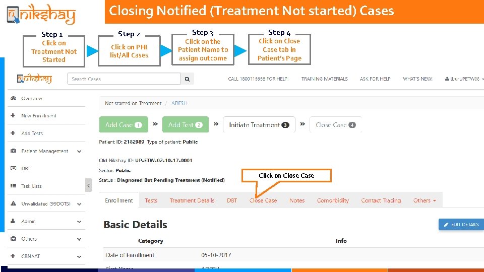 Closing Notified (Treatment Not started) Cases Step 1 Click on Treatment Not Started Step