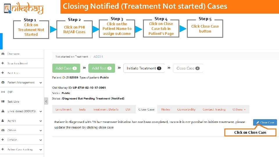 Closing Notified (Treatment Not started) Cases Step 1 Click on Treatment Not Started Step