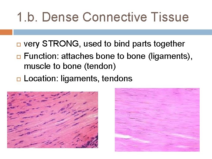 1. b. Dense Connective Tissue very STRONG, used to bind parts together Function: attaches