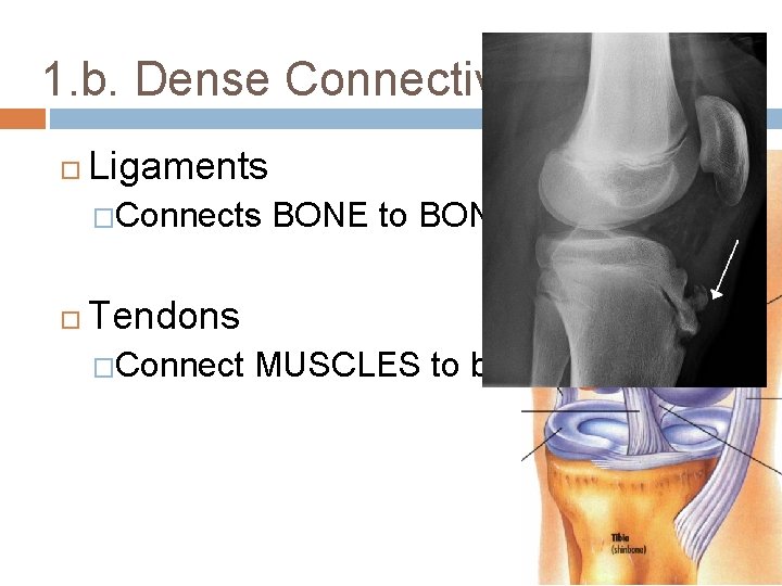 1. b. Dense Connective Tissue Ligaments �Connects BONE to BONE Tendons �Connect MUSCLES to