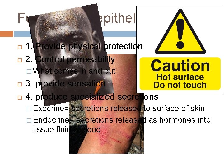 Functions of epithelia… 1. Provide physical protection 2. Control permeability � What comes in