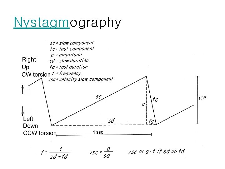 Nystagmography 