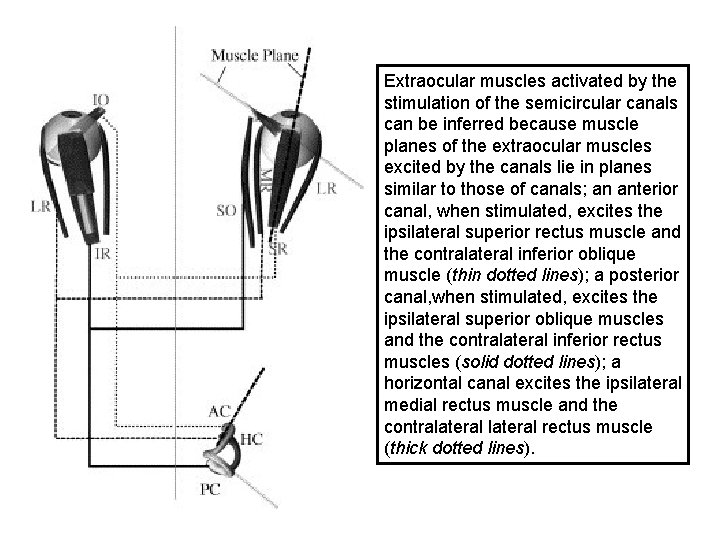 Extraocular muscles activated by the stimulation of the semicircular canals can be inferred because